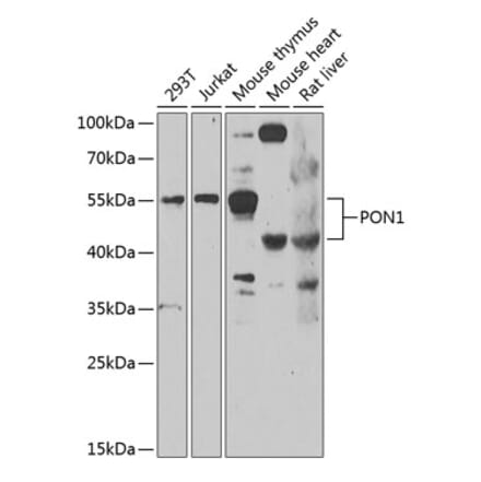 Western Blot - Anti-PON1 Antibody (A10119) - Antibodies.com