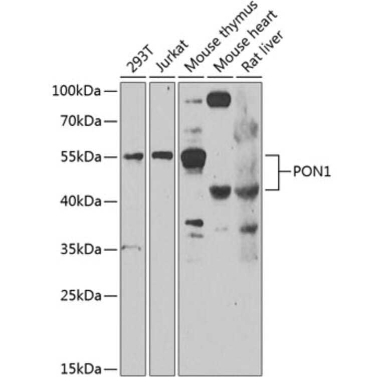 Western Blot - Anti-PON1 Antibody (A10119) - Antibodies.com