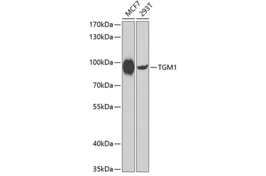 Western Blot - Anti-TGM1 Antibody (A7343) - Antibodies.com