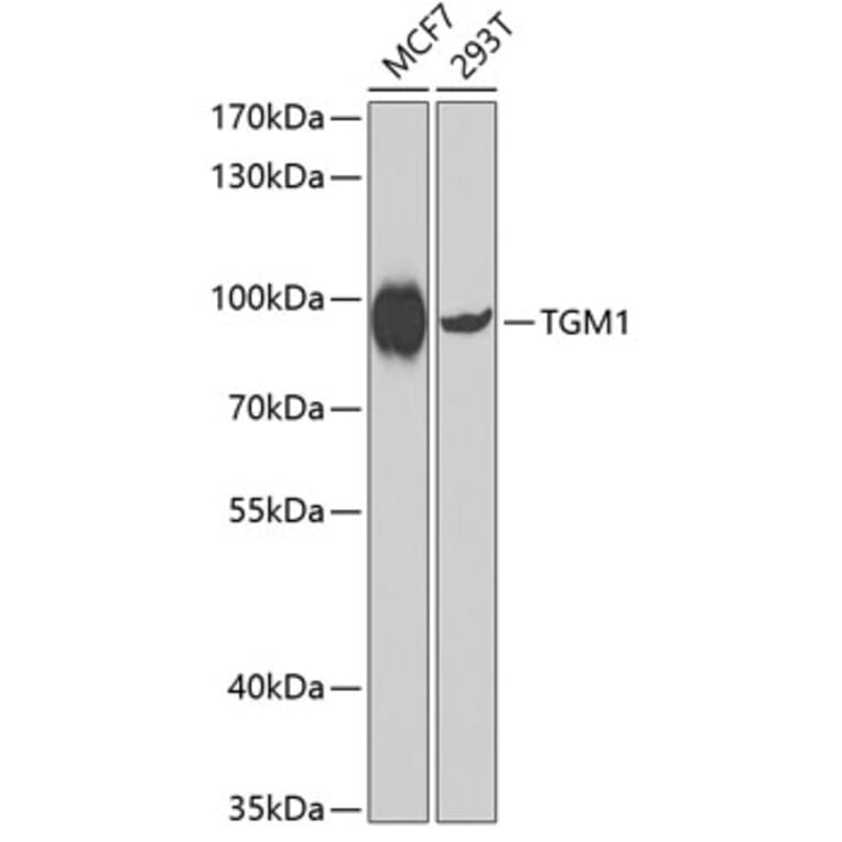 Western Blot - Anti-TGM1 Antibody (A7343) - Antibodies.com