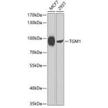 Western Blot - Anti-TGM1 Antibody (A7343) - Antibodies.com