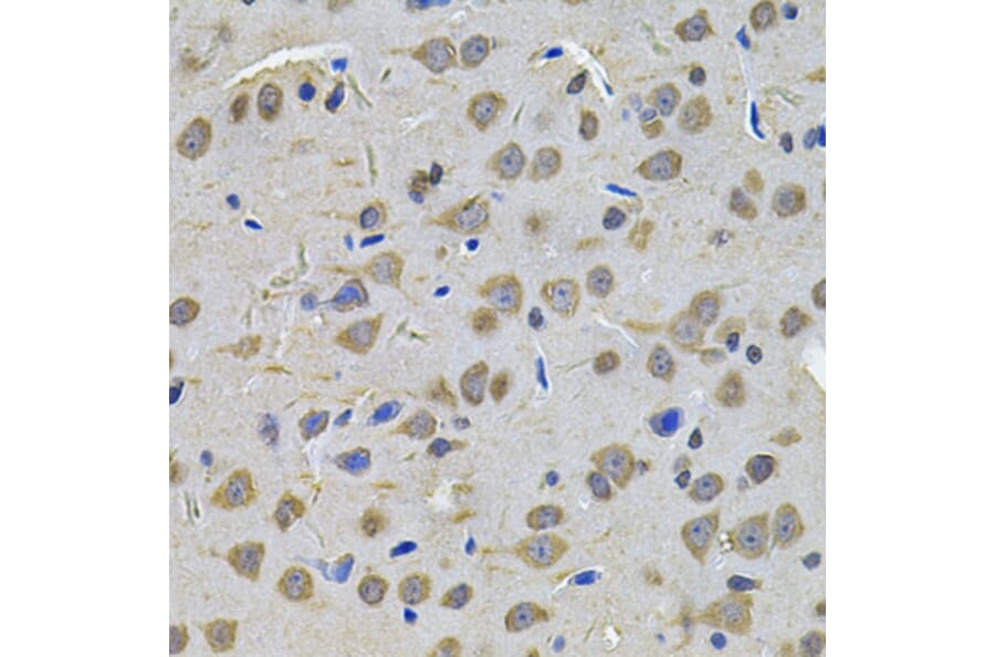 Immunohistochemistry - Anti-TGM1 Antibody (A7343) - Antibodies.com
