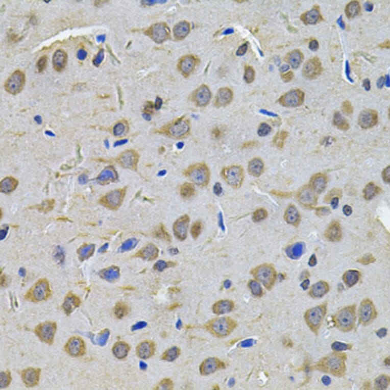 Immunohistochemistry - Anti-TGM1 Antibody (A7343) - Antibodies.com