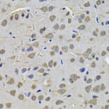 Immunohistochemistry - Anti-TGM1 Antibody (A7343) - Antibodies.com