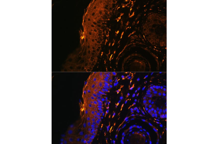 Immunofluorescence - Anti-TGM1 Antibody (A7343) - Antibodies.com
