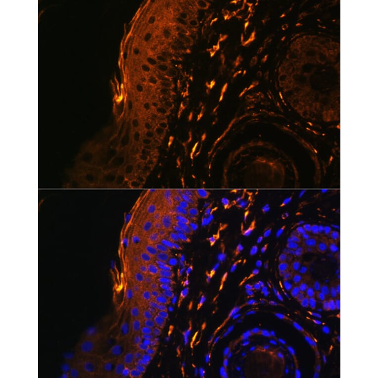 Immunofluorescence - Anti-TGM1 Antibody (A7343) - Antibodies.com