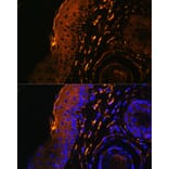 Immunofluorescence - Anti-TGM1 Antibody (A7343) - Antibodies.com