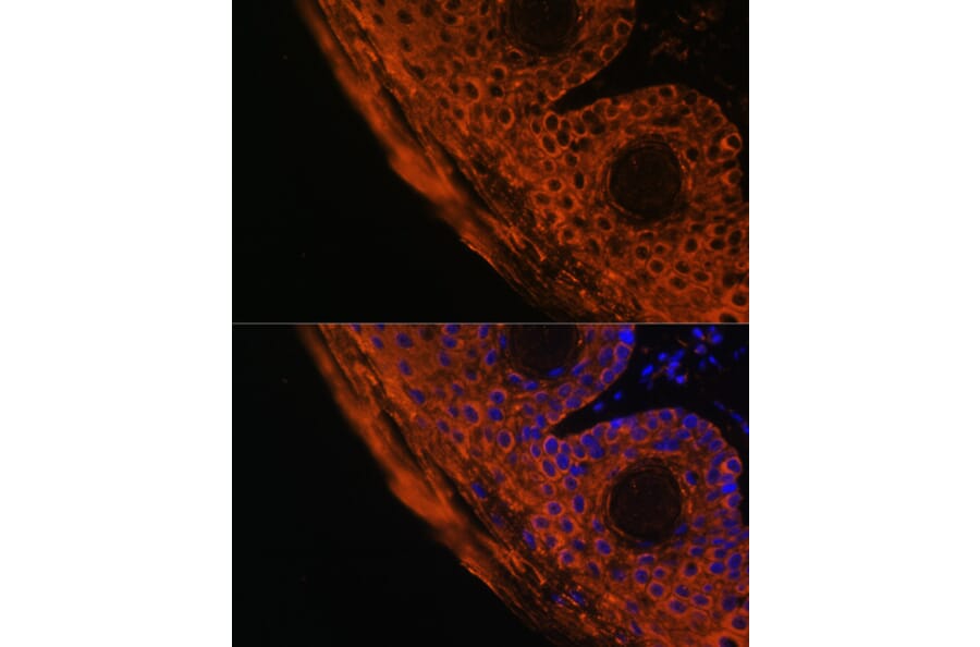 Immunofluorescence - Anti-TGM1 Antibody (A7343) - Antibodies.com