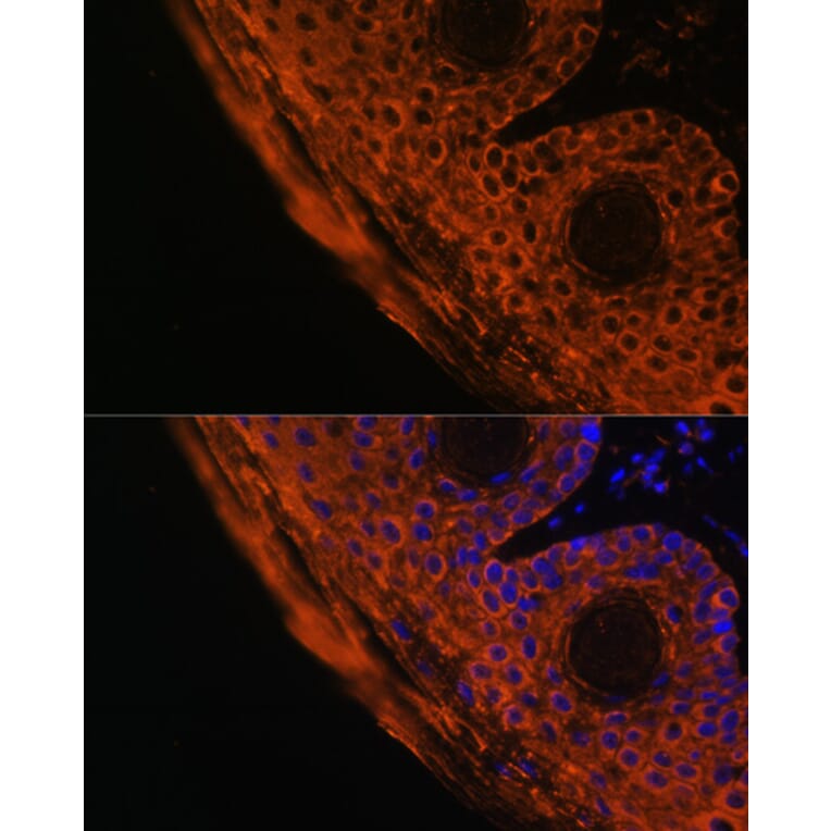 Immunofluorescence - Anti-TGM1 Antibody (A7343) - Antibodies.com