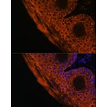 Immunofluorescence - Anti-TGM1 Antibody (A7343) - Antibodies.com