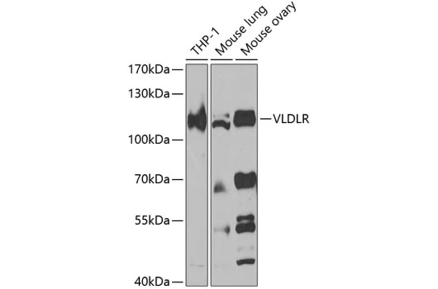 Western Blot - Anti-VLDL Receptor/VLDL-R Antibody (A10121) - Antibodies.com