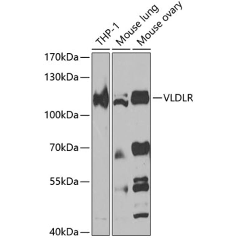 Western Blot - Anti-VLDL Receptor/VLDL-R Antibody (A10121) - Antibodies.com