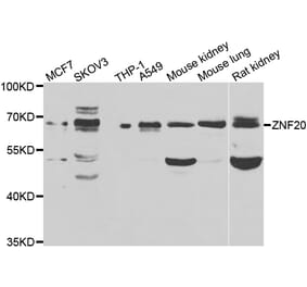 Western Blot - Anti-ZNF20 Antibody (A7346) - Antibodies.com