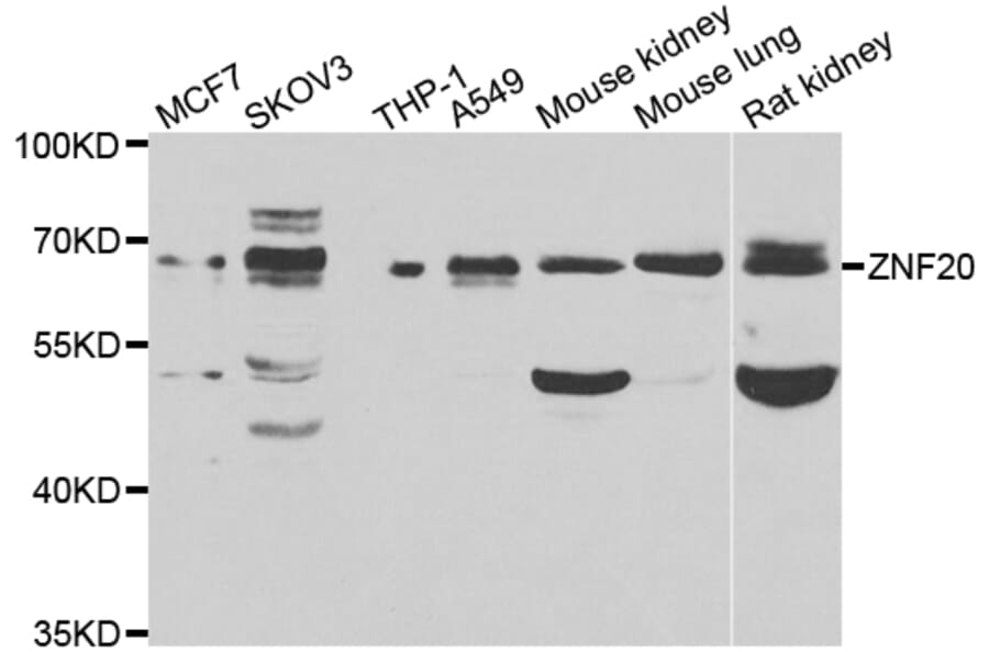 Western Blot - Anti-ZNF20 Antibody (A7346) - Antibodies.com