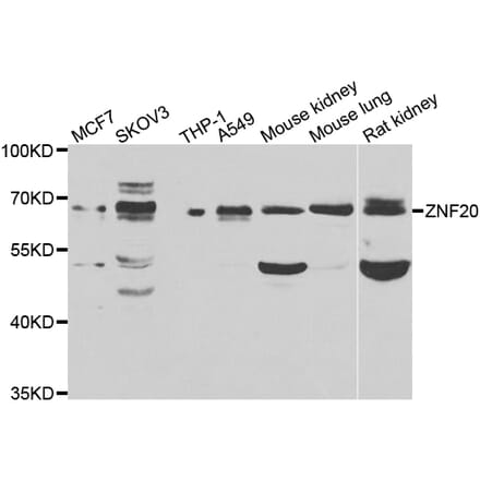 Western Blot - Anti-ZNF20 Antibody (A7346) - Antibodies.com