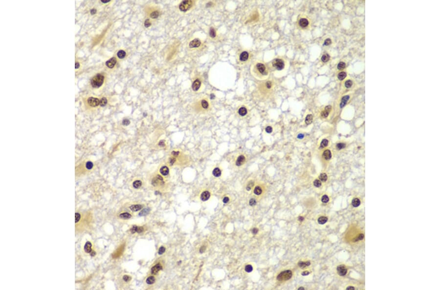 Immunohistochemistry - Anti-ZNF20 Antibody (A7346) - Antibodies.com