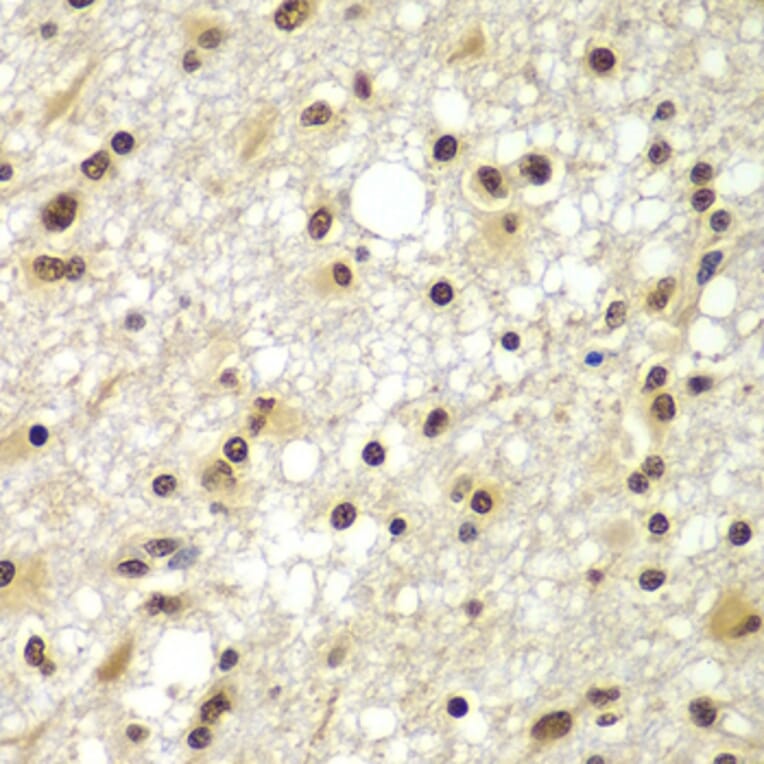 Immunohistochemistry - Anti-ZNF20 Antibody (A7346) - Antibodies.com