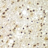 Immunohistochemistry - Anti-ZNF20 Antibody (A7346) - Antibodies.com