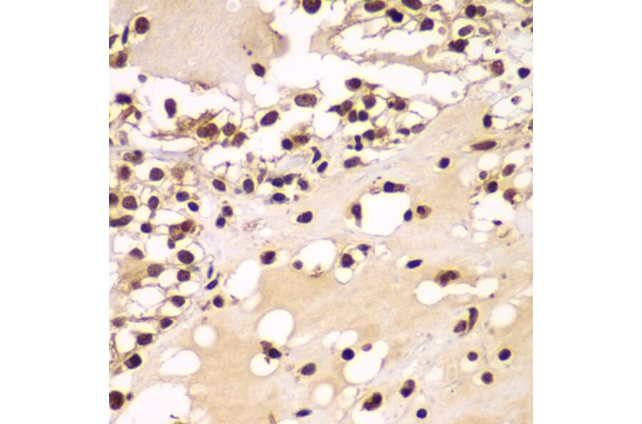 Immunohistochemistry - Anti-ZNF20 Antibody (A7346) - Antibodies.com