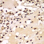 Immunohistochemistry - Anti-ZNF20 Antibody (A7346) - Antibodies.com
