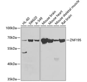 Western Blot - Anti-ZNF195 Antibody (A10123) - Antibodies.com