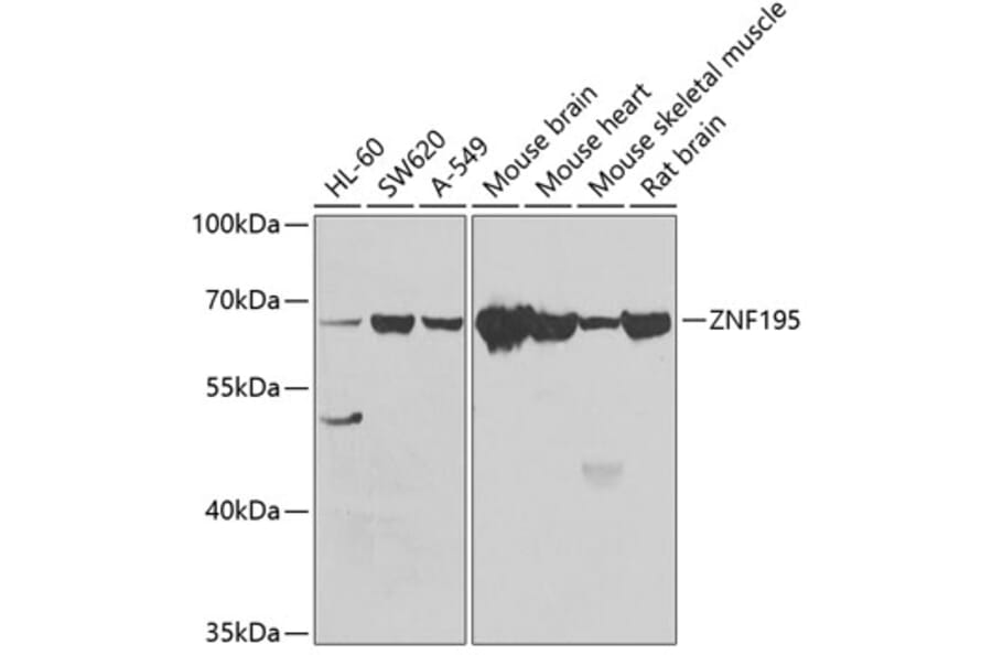Western Blot - Anti-ZNF195 Antibody (A10123) - Antibodies.com