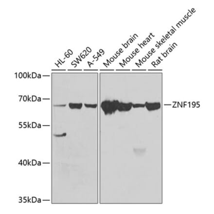 Western Blot - Anti-ZNF195 Antibody (A10123) - Antibodies.com