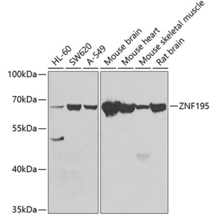 Western Blot - Anti-ZNF195 Antibody (A10123) - Antibodies.com