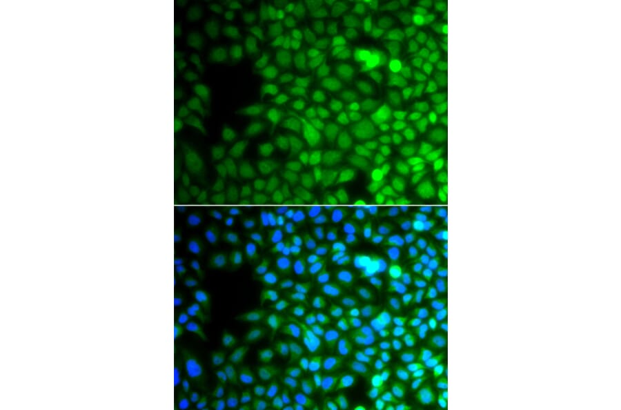 Immunofluorescence - Anti-ZNF195 Antibody (A10123) - Antibodies.com