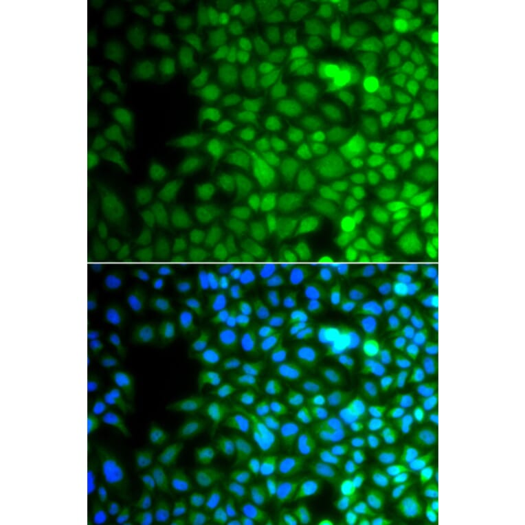 Immunofluorescence - Anti-ZNF195 Antibody (A10123) - Antibodies.com