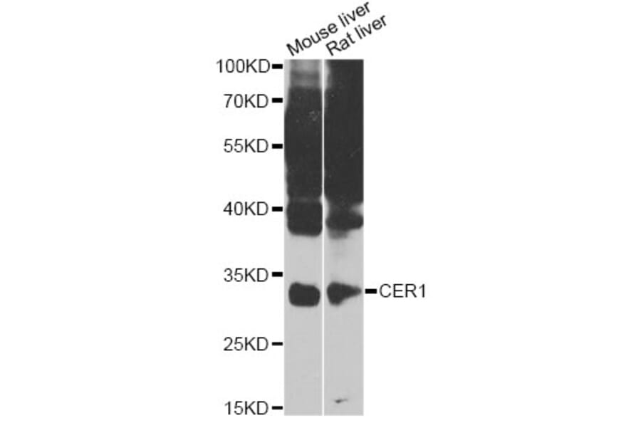 Western Blot - Anti-CER1 Antibody (A7354) - Antibodies.com
