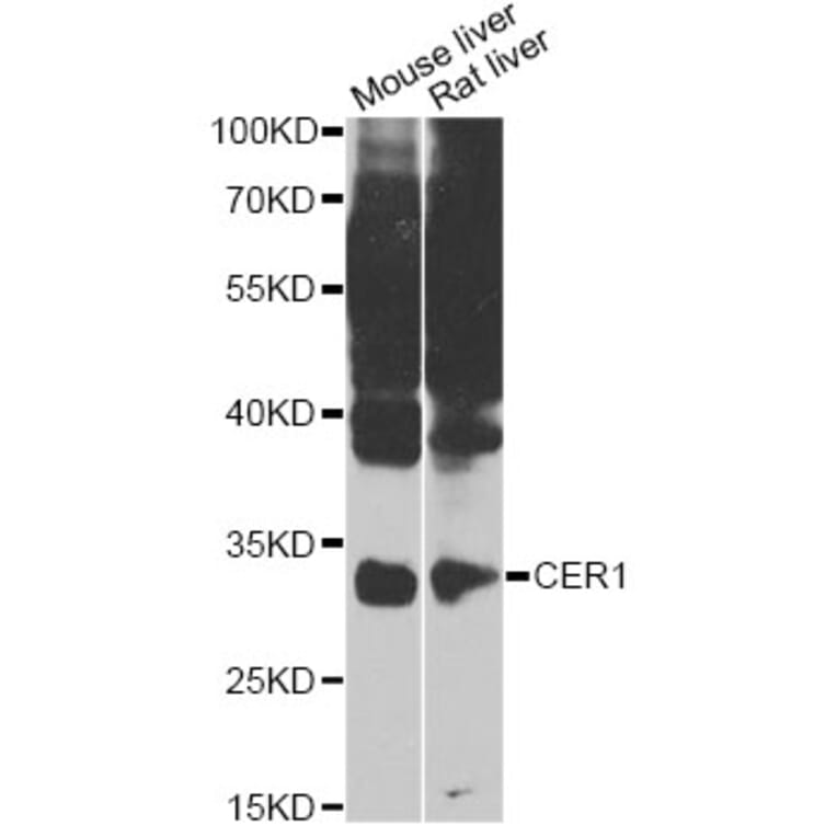 Western Blot - Anti-CER1 Antibody (A7354) - Antibodies.com