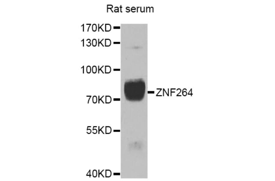 Western Blot - Anti-ZNF264 Antibody (A7356) - Antibodies.com