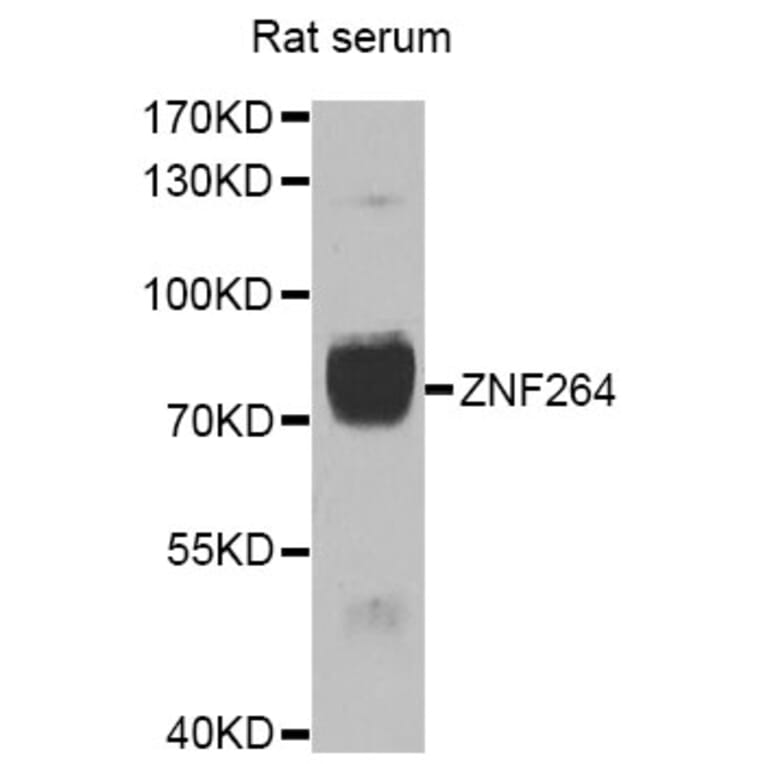 Western Blot - Anti-ZNF264 Antibody (A7356) - Antibodies.com