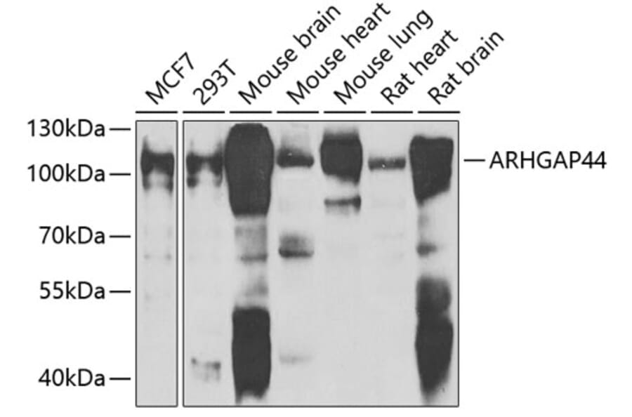 Western Blot - Anti-ARHGAP44 Antibody (A10127) - Antibodies.com