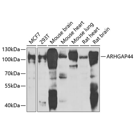 Western Blot - Anti-ARHGAP44 Antibody (A10127) - Antibodies.com