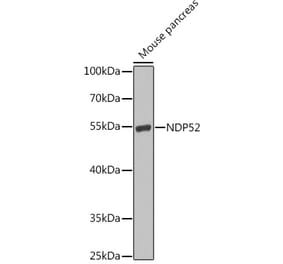 Western Blot - Anti-NDP52 Antibody (A10128) - Antibodies.com