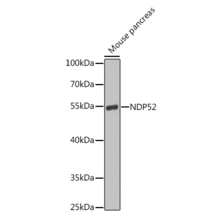 Western Blot - Anti-NDP52 Antibody (A10128) - Antibodies.com