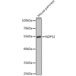 Western Blot - Anti-NDP52 Antibody (A10128) - Antibodies.com