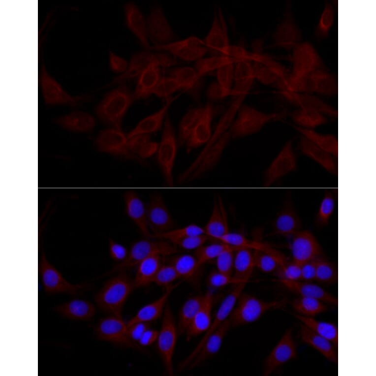 Immunofluorescence - Anti-NDP52 Antibody (A10128) - Antibodies.com