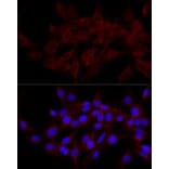 Immunofluorescence - Anti-NDP52 Antibody (A10128) - Antibodies.com