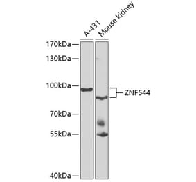 Western Blot - Anti-ZNF544 Antibody (A10129) - Antibodies.com