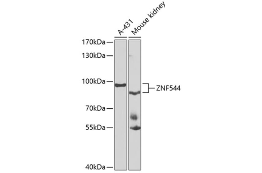 Western Blot - Anti-ZNF544 Antibody (A10129) - Antibodies.com