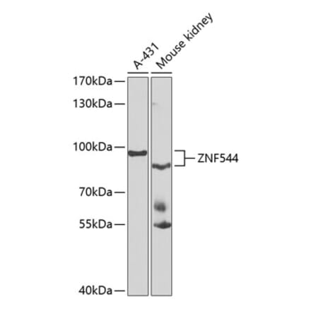 Western Blot - Anti-ZNF544 Antibody (A10129) - Antibodies.com