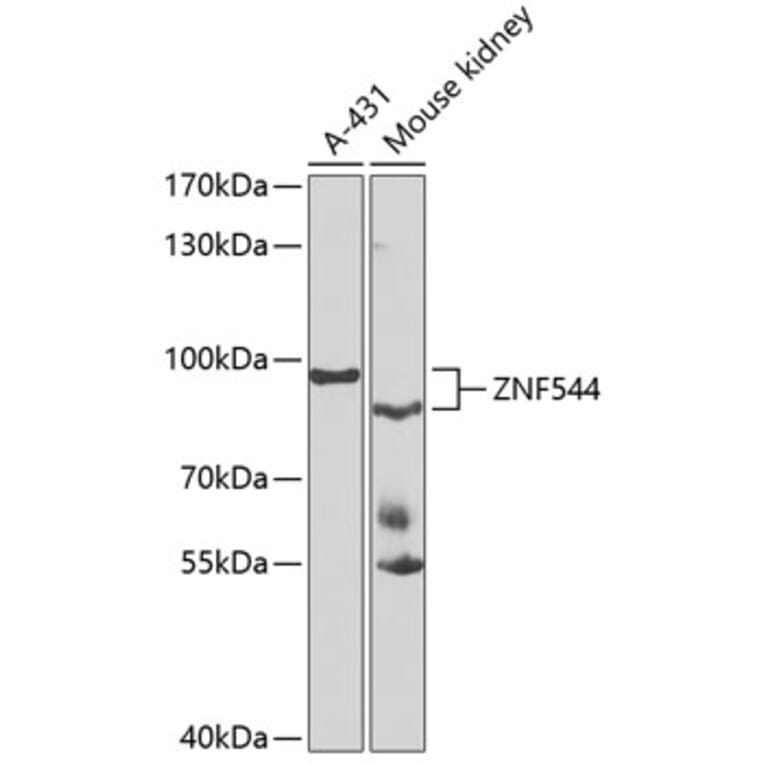 Western Blot - Anti-ZNF544 Antibody (A10129) - Antibodies.com