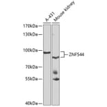 Western Blot - Anti-ZNF544 Antibody (A10129) - Antibodies.com