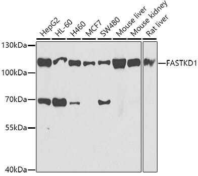 Western blot analysis of extracts of various cell lines, using Anti-FASTKD1 Antibody (A7384) at 1:1,000 dilution.
Secondary antibody: Goat Anti-Rabbit IgG (H+L) (HRP) (AS014) at 1:10,000 dilution.
Lysates / proteins: 25µg per lane.
Blocking buffer: 3% non-fat dry milk in TBST.
Detection: ECL Basic Kit (RM00020).
Exposure time: 90s.