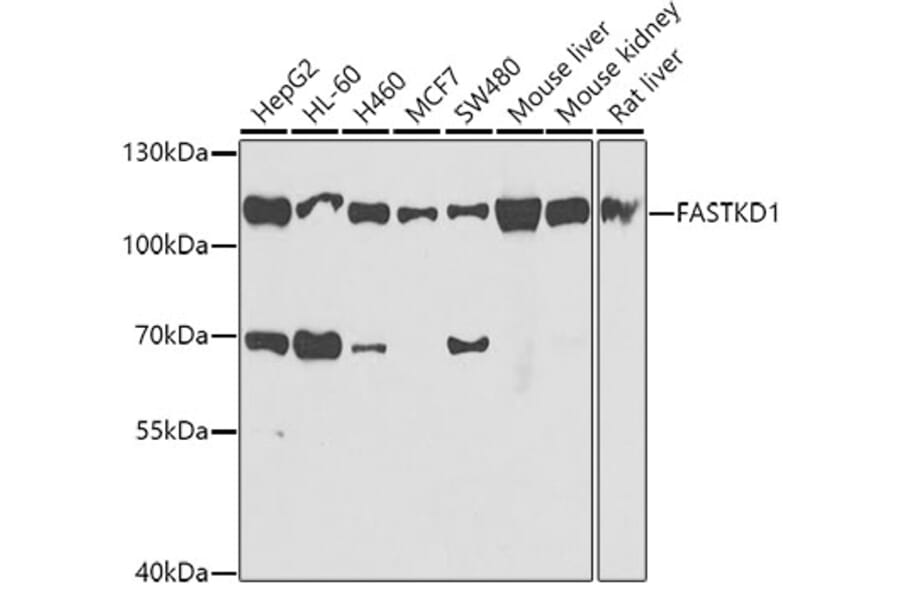 Western Blot - Anti-FASTKD1 Antibody (A10132) - Antibodies.com