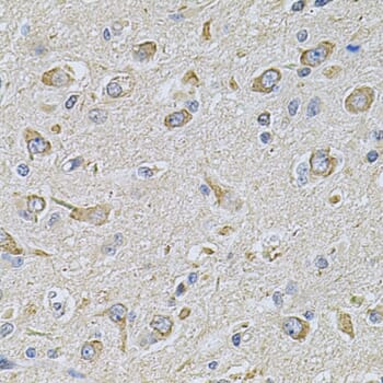 Immunohistochemistry of paraffin-embedded rat brain using Anti-FASTKD1 Antibody (A7384) at dilution of 1:100 (40x lens).