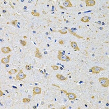 Immunohistochemistry of paraffin-embedded mouse brain using Anti-FASTKD1 Antibody (A7384) at dilution of 1:100 (40x lens).